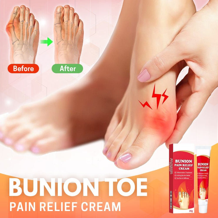 Bunion Toe Relief Cream - Sp-rona.co.uk