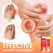 Bunion Toe Relief Cream - Sp-rona.co.uk