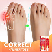 Bunion Toe Relief Cream - Sp-rona.co.uk